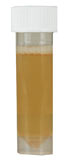 Bacteria Test Results, positive, yellow